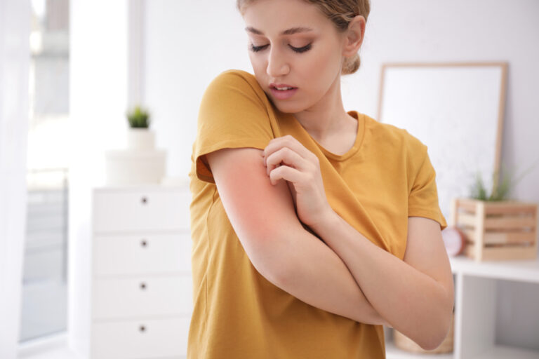 Person showing skin irritation on arm